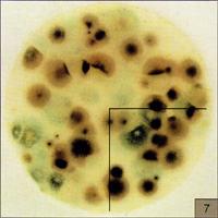 霉菌酵母菌測試片