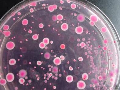 霉菌和酵母菌及其檢驗